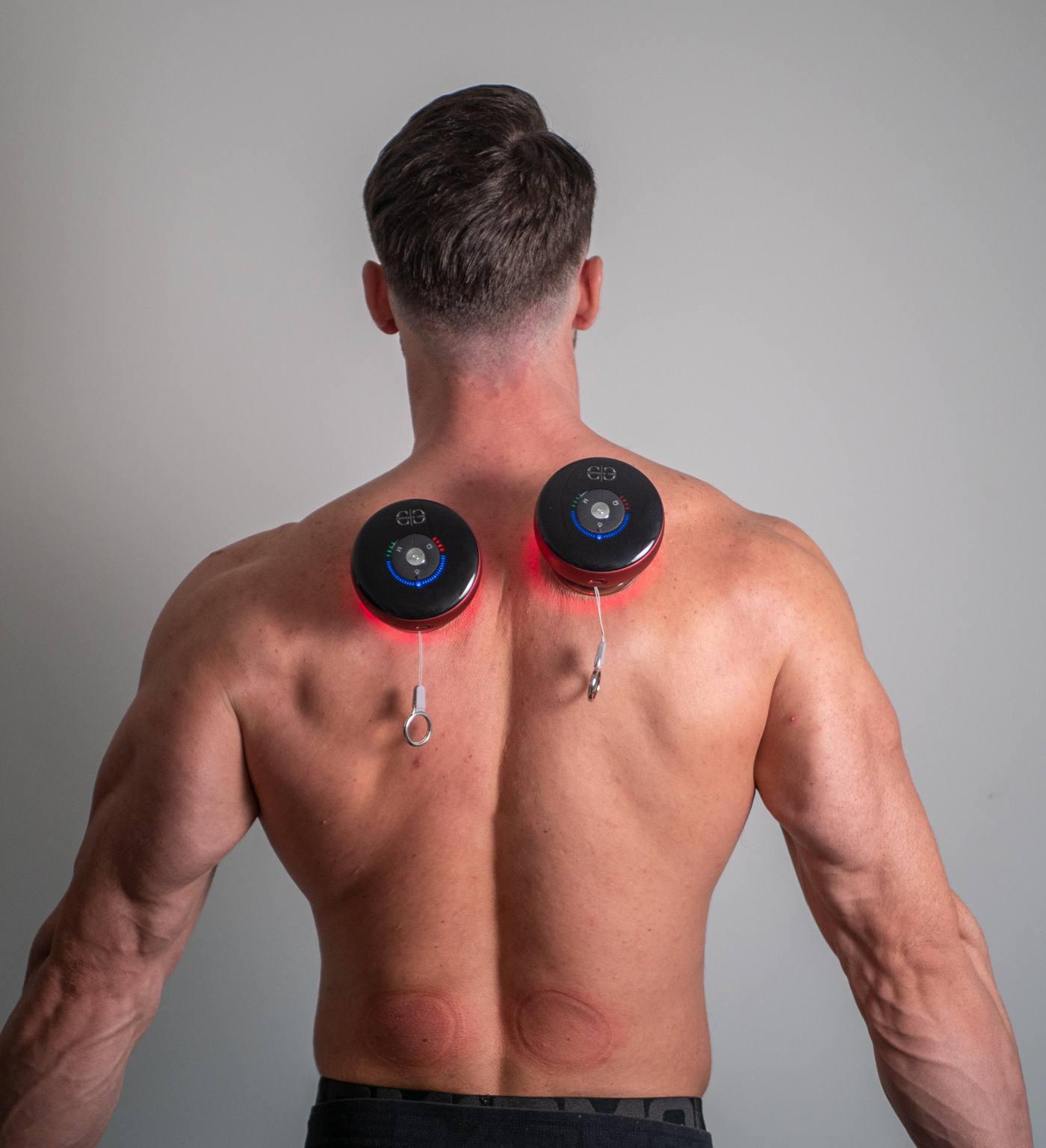 Hvad kan smart cupping